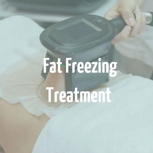 fat freezing treatment Bridgnorth