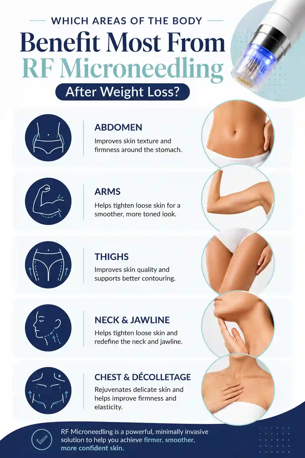 Which Areas of the Body Benefit Most From RF Microneedling After Weight Loss Bridgnorth